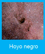 Hoyo-negro