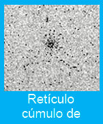 Reticulo